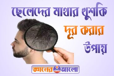 ছেলেদের মাথায় খুশকির কারণ এবং দূর করার উপায়