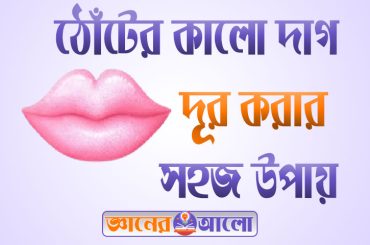 ঠোঁট কালো হওয়ার কারণ এবং কালো দাগ দূর করার সহজ ঘরোয়া উপায়