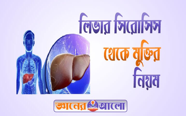 লিভার সিরোসিস থেকে মুক্তির উপায়